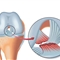 پارگی رباط صلیبی و آشنایی با نحوه تشخیص و درمان به موقع!