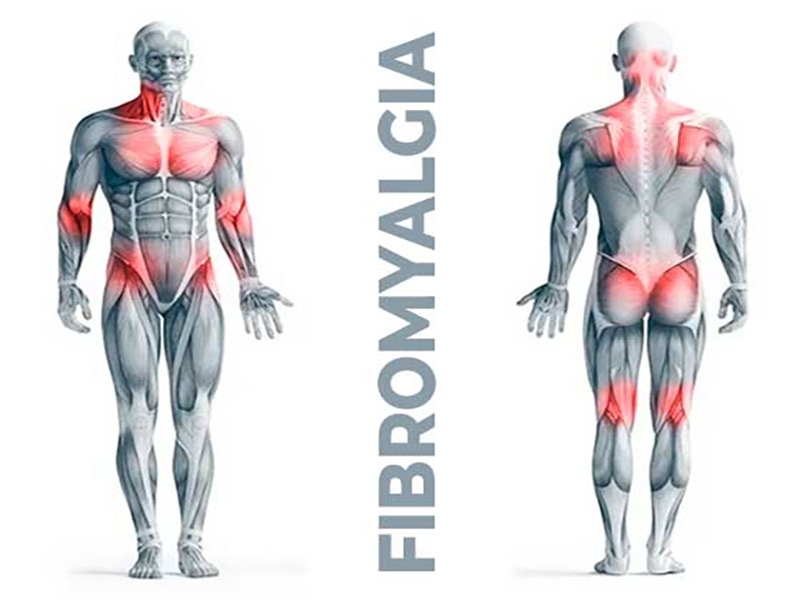 فیبرومیالژیا: بیماری ناشناخته‌ای که زندگی را تحت تاثیر قرار می‌دهد